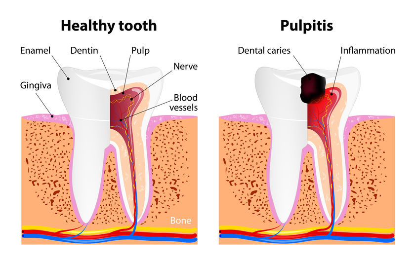 Tooth Health